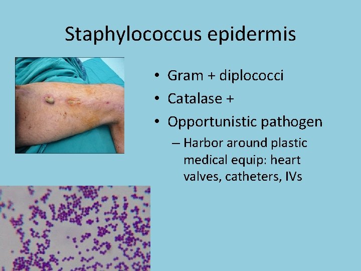 Staphylococcus epidermis • Gram + diplococci • Catalase + • Opportunistic pathogen – Harbor
