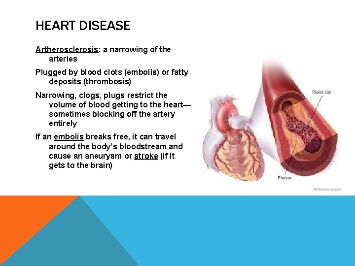 HEART DISEASE Artherosclerosis: a narrowing of the arteries Plugged by blood clots (embolis) or