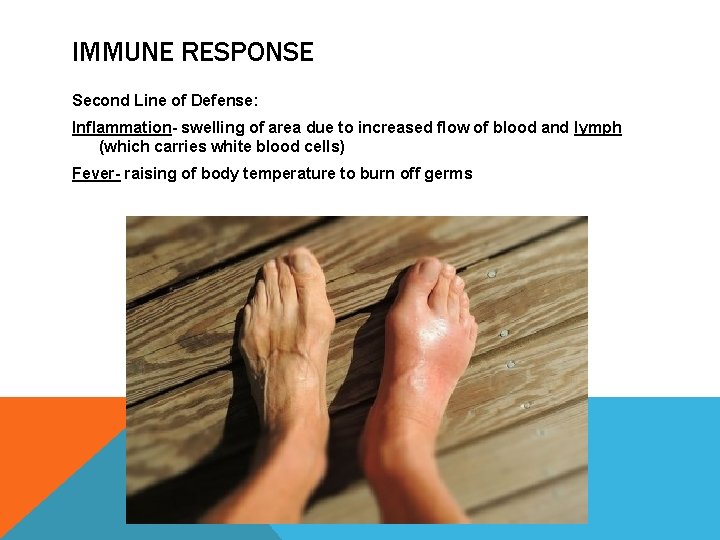 IMMUNE RESPONSE Second Line of Defense: Inflammation- swelling of area due to increased flow