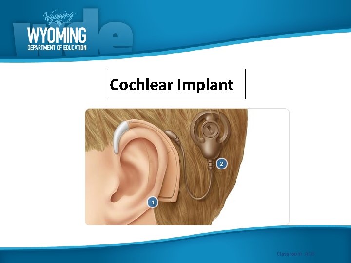 Cochlear Implant Classroom ADS 