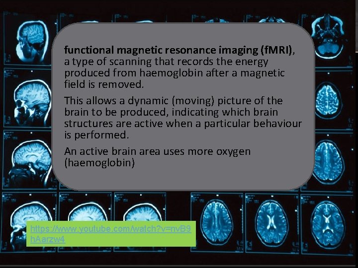 functional magnetic resonance imaging (f. MRI), a type of scanning that records the energy