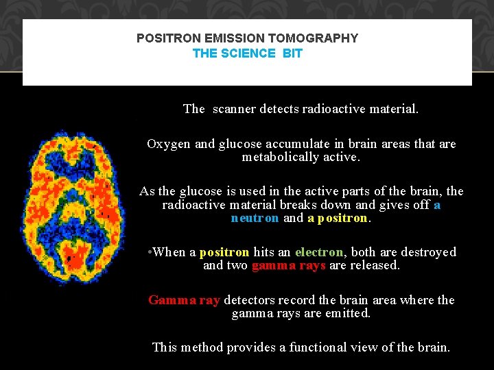 POSITRON EMISSION TOMOGRAPHY THE SCIENCE BIT The scanner detects radioactive material. Oxygen and glucose