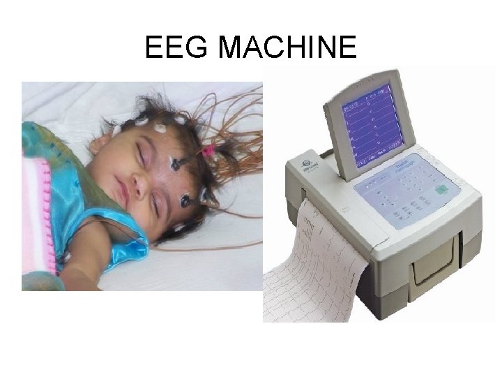 EEG MACHINE 