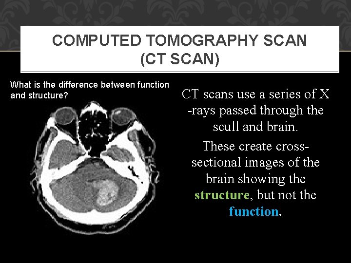 COMPUTED TOMOGRAPHY SCAN (CT SCAN) What is the difference between function and structure? CT