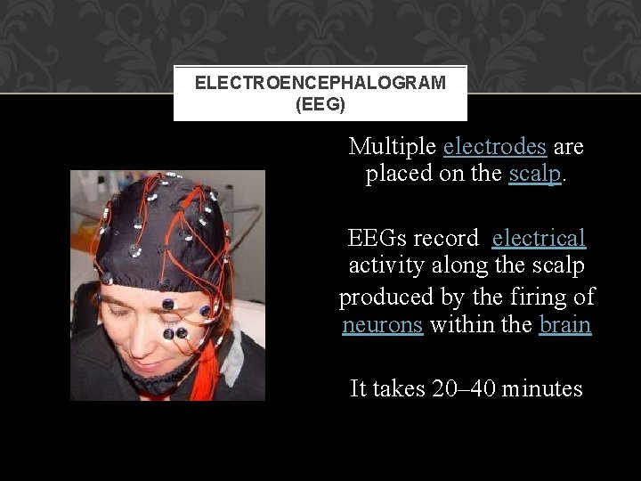 Ways to investigate the brain Methodology POST MORTEM