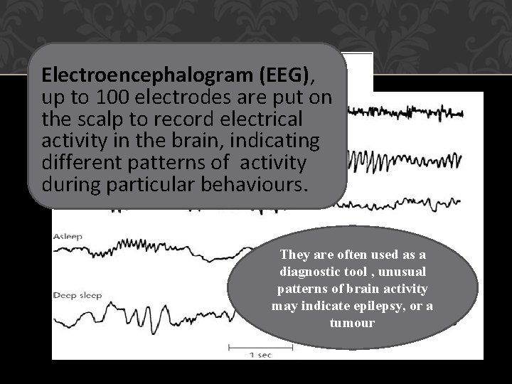 EEG READ OUT Electroencephalogram (EEG), up to 100 electrodes are put on the scalp