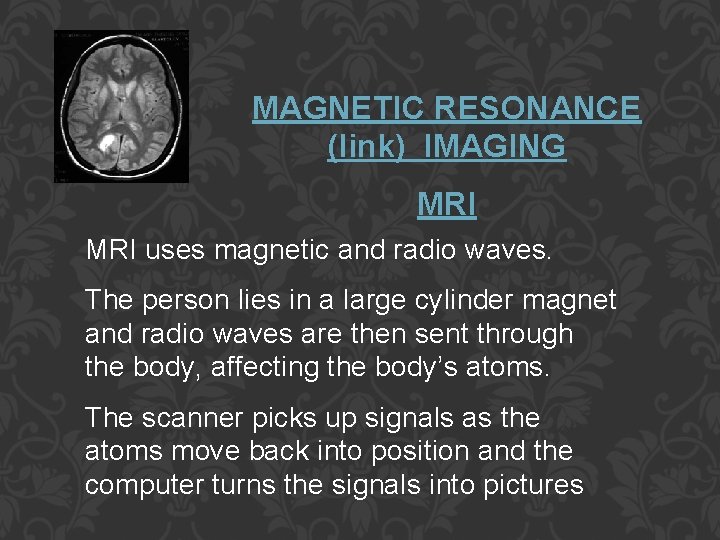 MAGNETIC RESONANCE (link) IMAGING MRI uses magnetic and radio waves. The person lies in