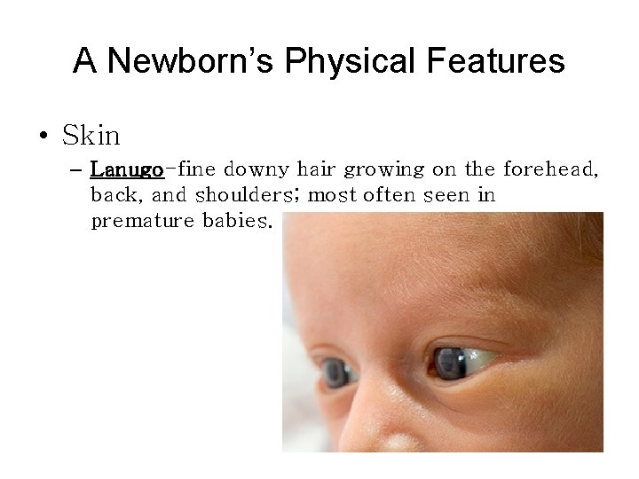 A Newborn’s Physical Features • Skin – Lanugo-fine downy hair growing on the forehead,