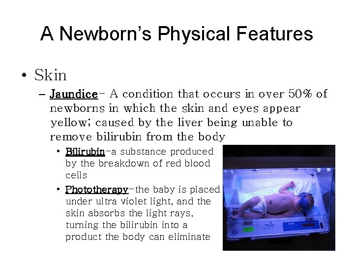 A Newborn’s Physical Features • Skin – Jaundice- A condition that occurs in over