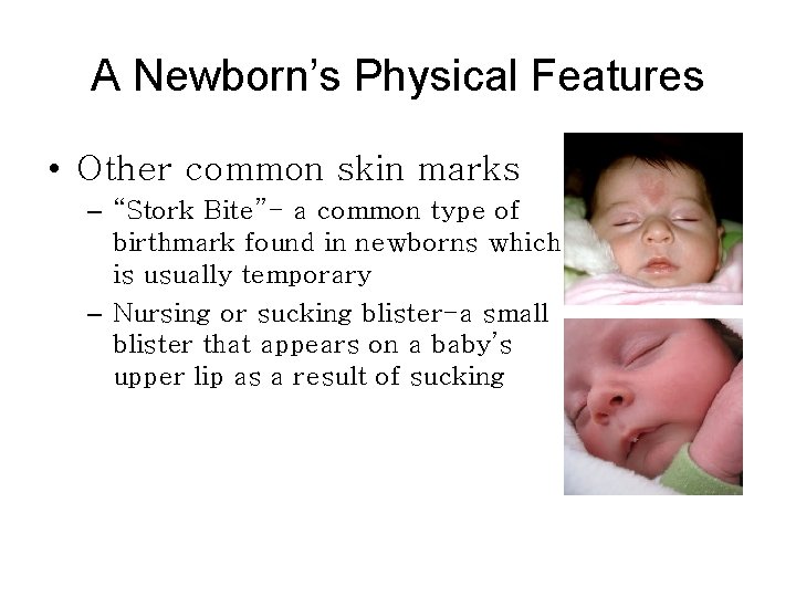 A Newborn’s Physical Features • Other common skin marks – “Stork Bite”- a common
