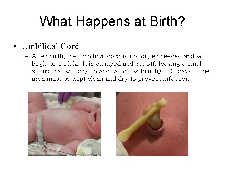 What Happens at Birth? • Umbilical Cord – After birth, the umbilical cord is