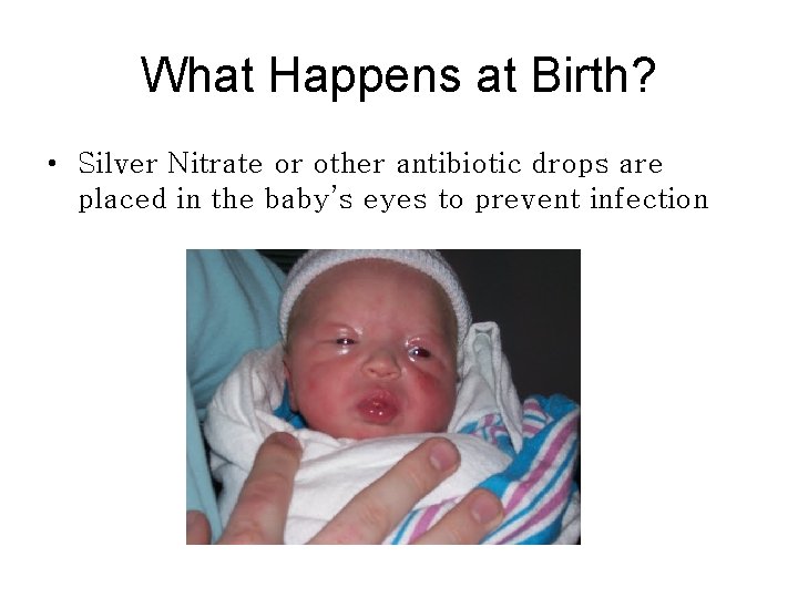 What Happens at Birth? • Silver Nitrate or other antibiotic drops are placed in