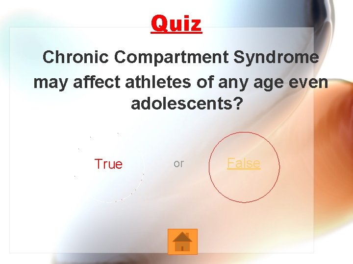 Quiz Chronic Compartment Syndrome may affect athletes of any age even adolescents? True or