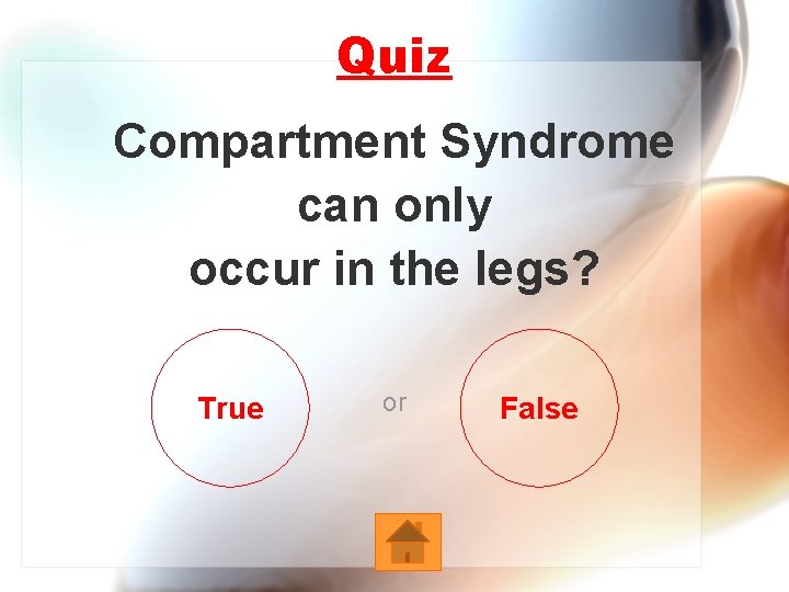 Quiz Compartment Syndrome can only occur in the legs? True or False 