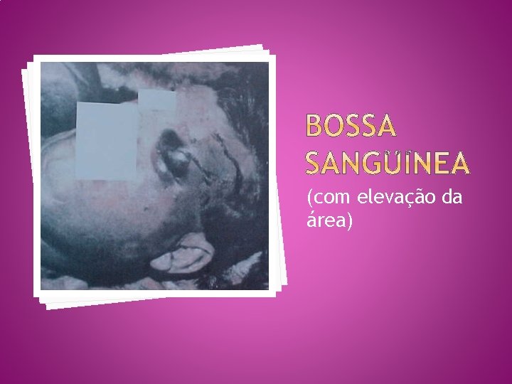 (com elevação da área) 