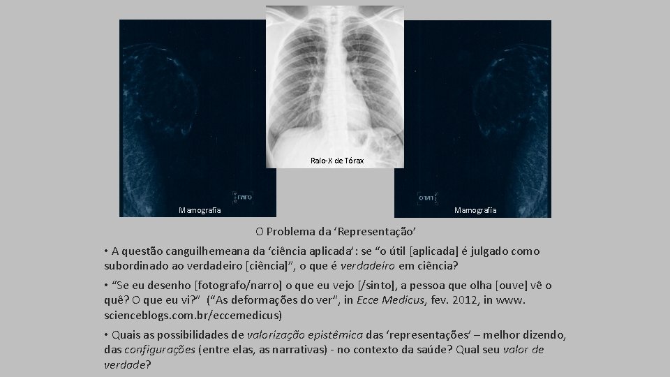 Raio-X de Tórax Mamografia O Problema da ‘Representação’ • A questão canguilhemeana da ‘ciência