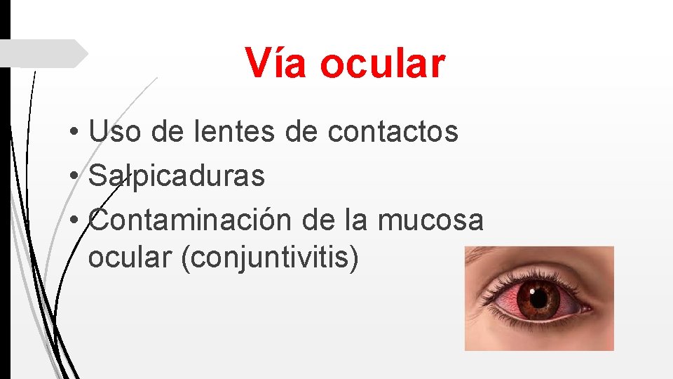 Vía ocular • Uso de lentes de contactos • Salpicaduras • Contaminación de la