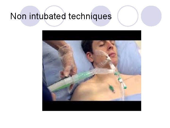 Non intubated techniques 