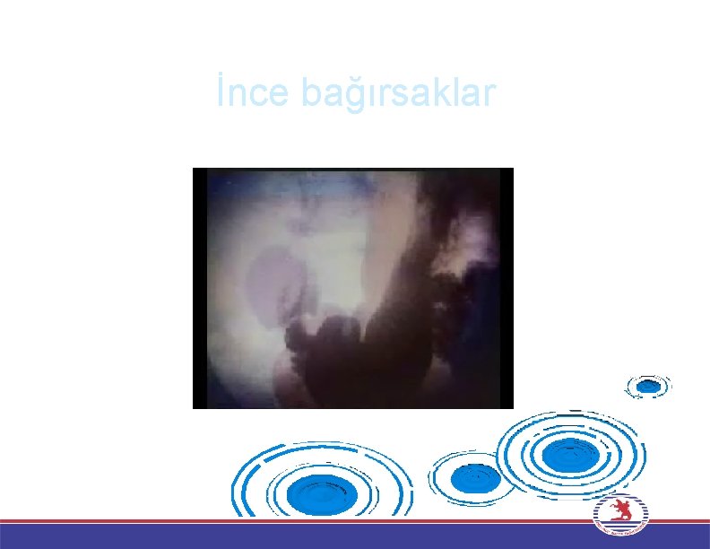 İnce bağırsaklar 