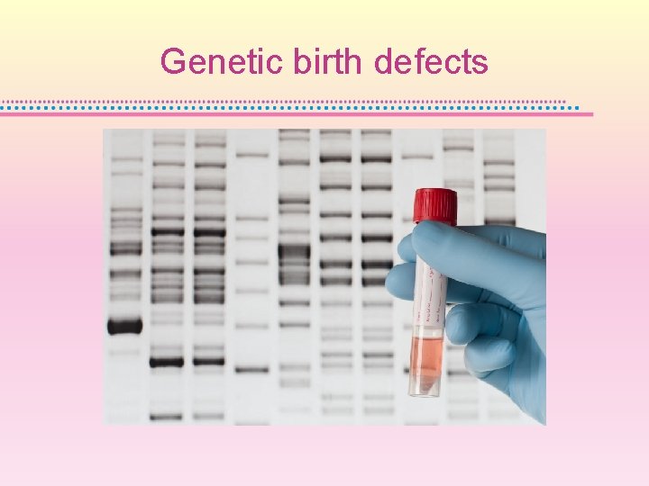 Genetic birth defects 