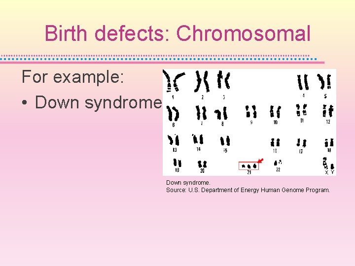 Birth defects: Chromosomal For example: • Down syndrome. Source: U. S. Department of Energy