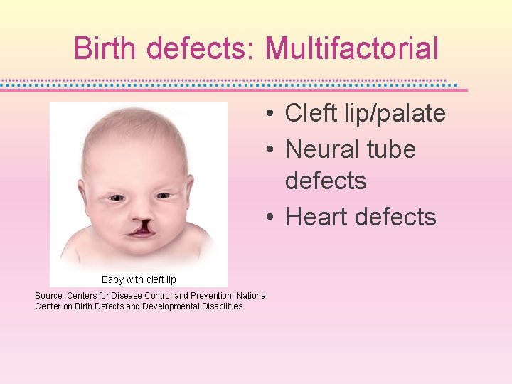 Birth defects: Multifactorial • Cleft lip/palate • Neural tube defects • Heart defects Source: