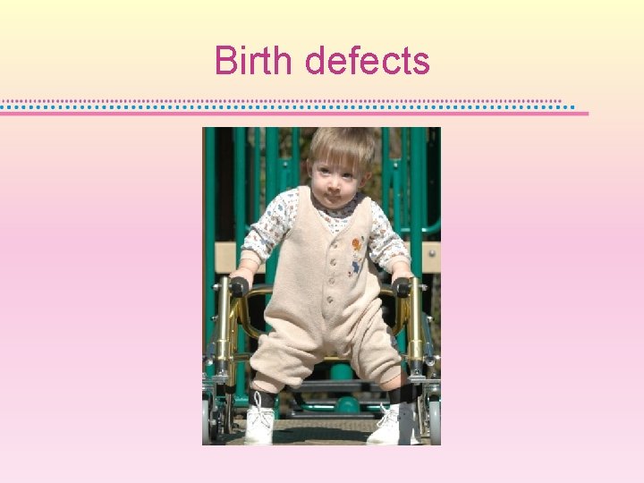 Birth defects 