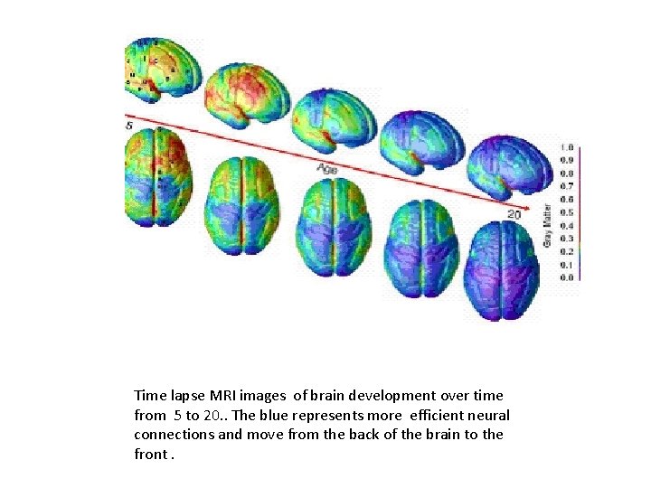 Time lapse MRI images of brain development over time from 5 to 20. .