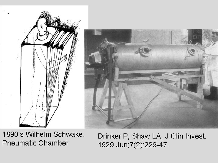 1890’s Wilhelm Schwake: Pneumatic Chamber Drinker P, Shaw LA. J Clin Invest. 1929 Jun;