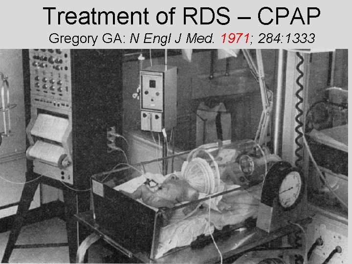 Treatment of RDS – CPAP Gregory GA: N Engl J Med. 1971; 284: 1333