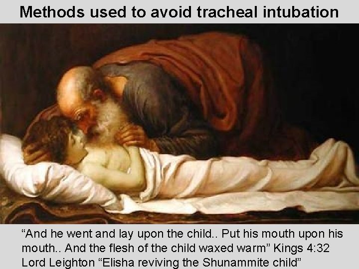 Methods used to avoid tracheal intubation “And he went and lay upon the child.