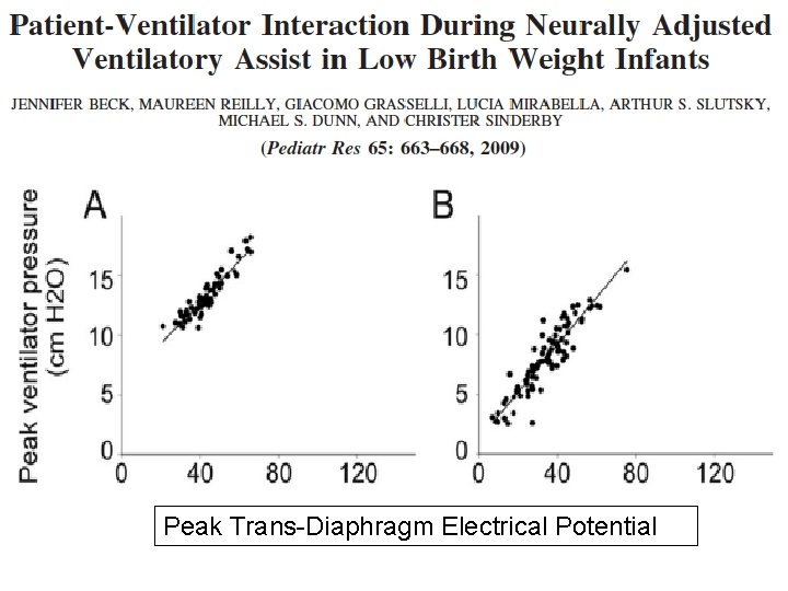 Peak Trans-Diaphragm Electrical Potential 