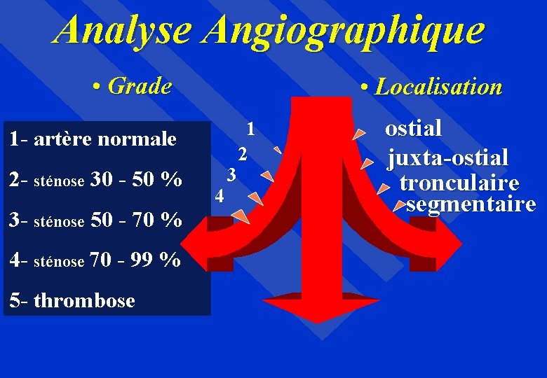 Analyse Angiographique • Grade • Localisation 1 - artère normale 2 - sténose 30
