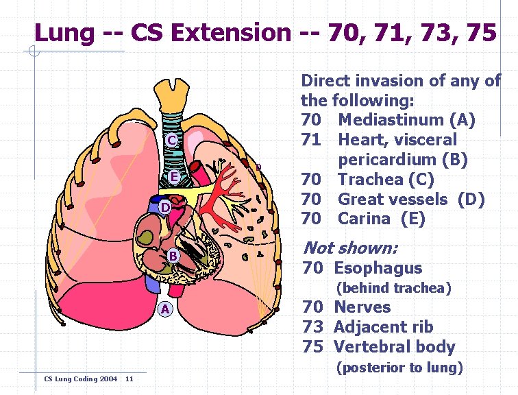 Lung -- CS Extension -- 70, 71, 73, 75 C E D B D