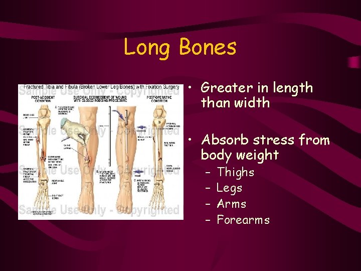 Long Bones • Greater in length than width • Absorb stress from body weight