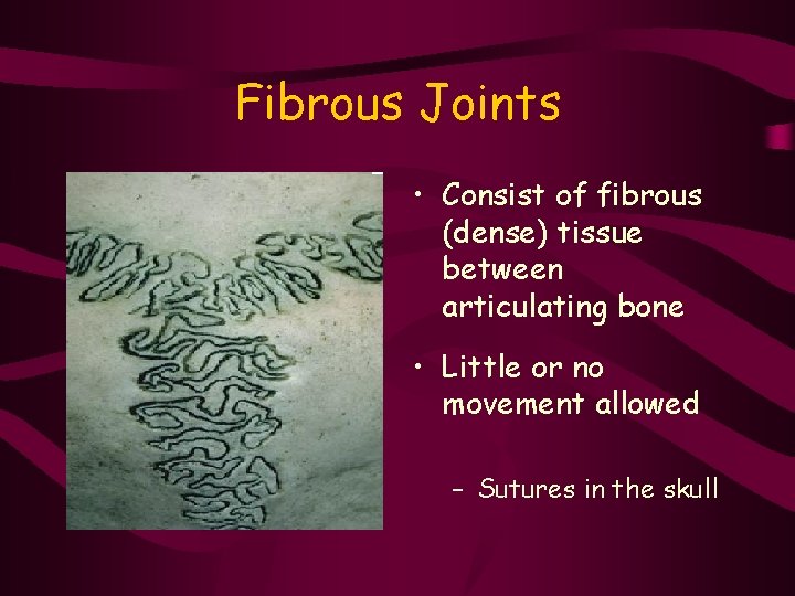 Fibrous Joints • Consist of fibrous (dense) tissue between articulating bone • Little or