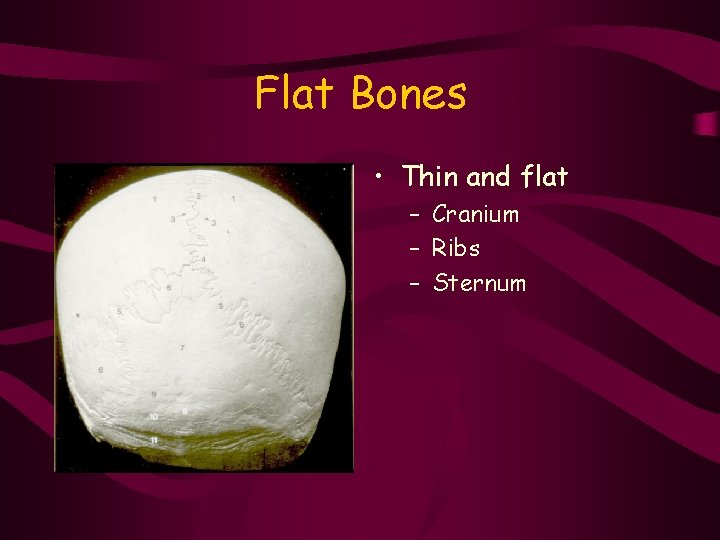 Flat Bones • Thin and flat – Cranium – Ribs – Sternum 