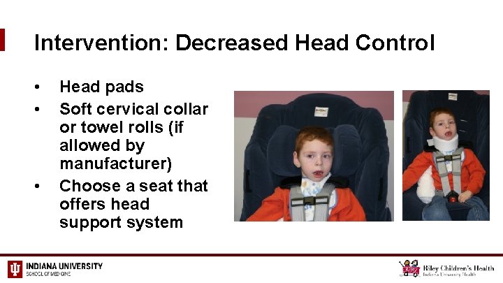 Intervention: Decreased Head Control • • • Head pads Soft cervical collar or towel