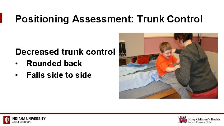 Positioning Assessment: Trunk Control Decreased trunk control • • Rounded back Falls side to