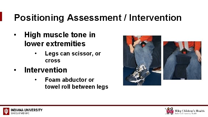 Positioning Assessment / Intervention • High muscle tone in lower extremities • • Legs