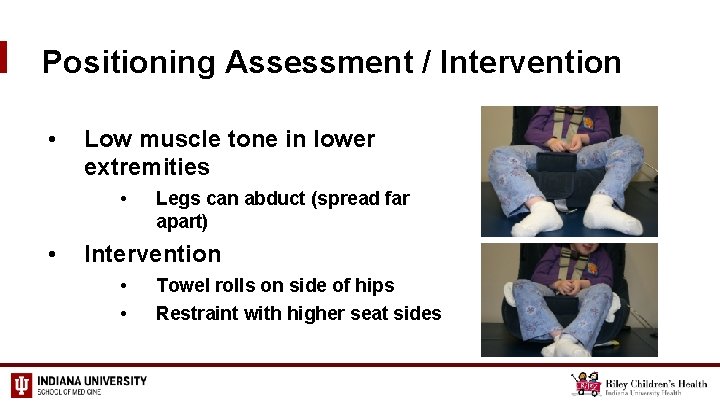 Positioning Assessment / Intervention • Low muscle tone in lower extremities • • Legs