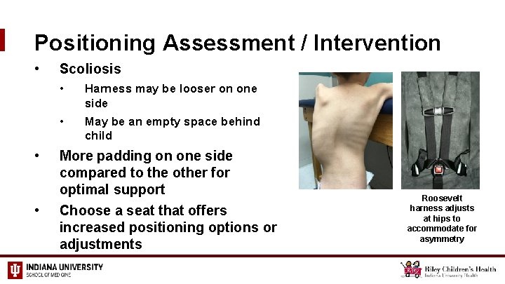 Positioning Assessment / Intervention • • • Scoliosis • Harness may be looser on