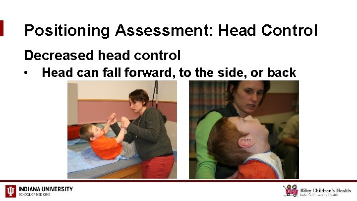 Positioning Assessment: Head Control Decreased head control • Head can fall forward, to the