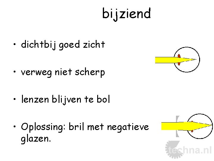 bijziend • dichtbij goed zicht • verweg niet scherp • lenzen blijven te bol