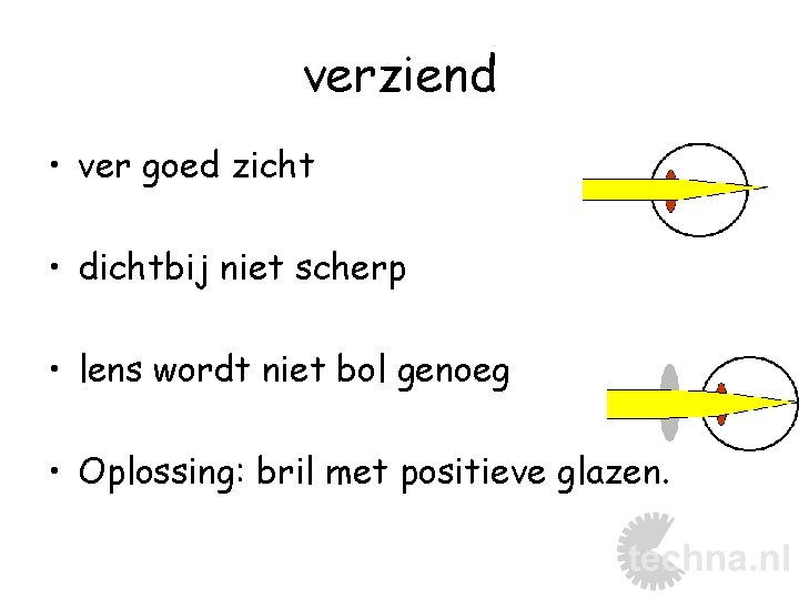 verziend • ver goed zicht • dichtbij niet scherp • lens wordt niet bol