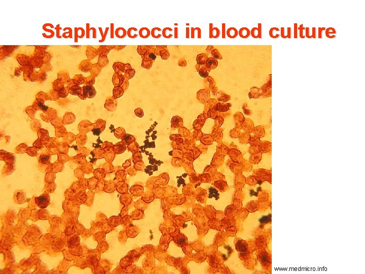 Staphylococci in blood culture www. medmicro. info 