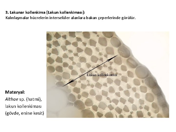 3. Lakunar kollenkima (Lakun kollenkiması): Kalınlaşmalar hücrelerin interselüler alanlara bakan çeperlerinde görülür. Materyal: Althae