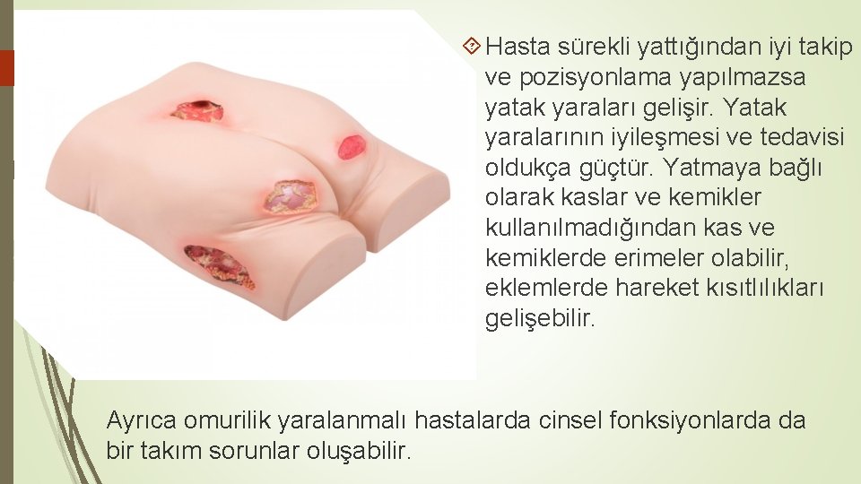  Hasta sürekli yattığından iyi takip ve pozisyonlama yapılmazsa yatak yaraları gelişir. Yatak yaralarının