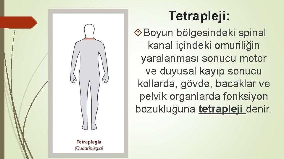 Tetrapleji: Boyun bölgesindeki spinal kanal içindeki omuriliğin yaralanması sonucu motor ve duyusal kayıp sonucu