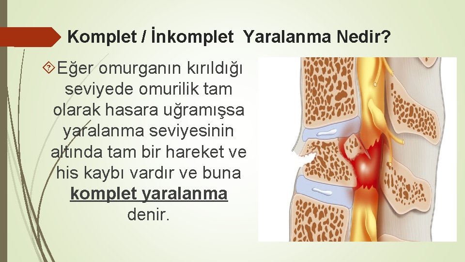 Komplet / İnkomplet Yaralanma Nedir? Eğer omurganın kırıldığı seviyede omurilik tam olarak hasara uğramışsa